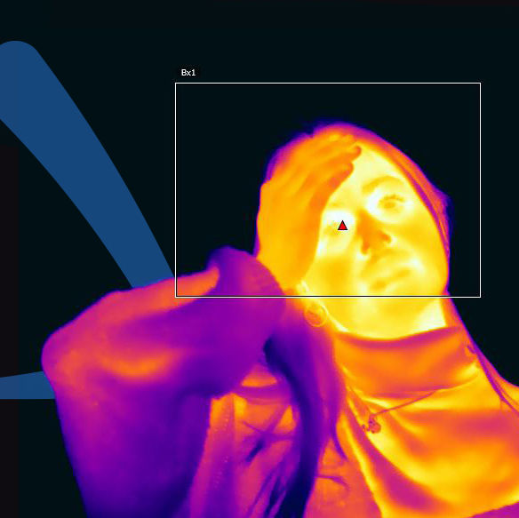 Medição da temperatura